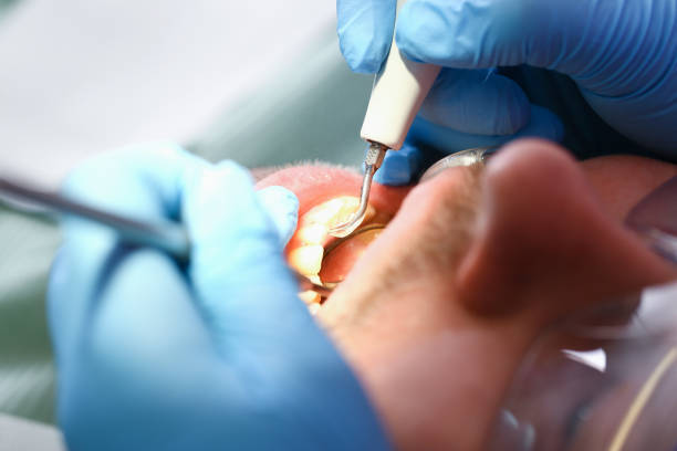 Best Pediatric Emergency Dentist in Granville, WV